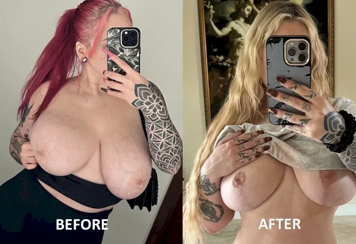 Skylar Vox boob job - before and after comparison